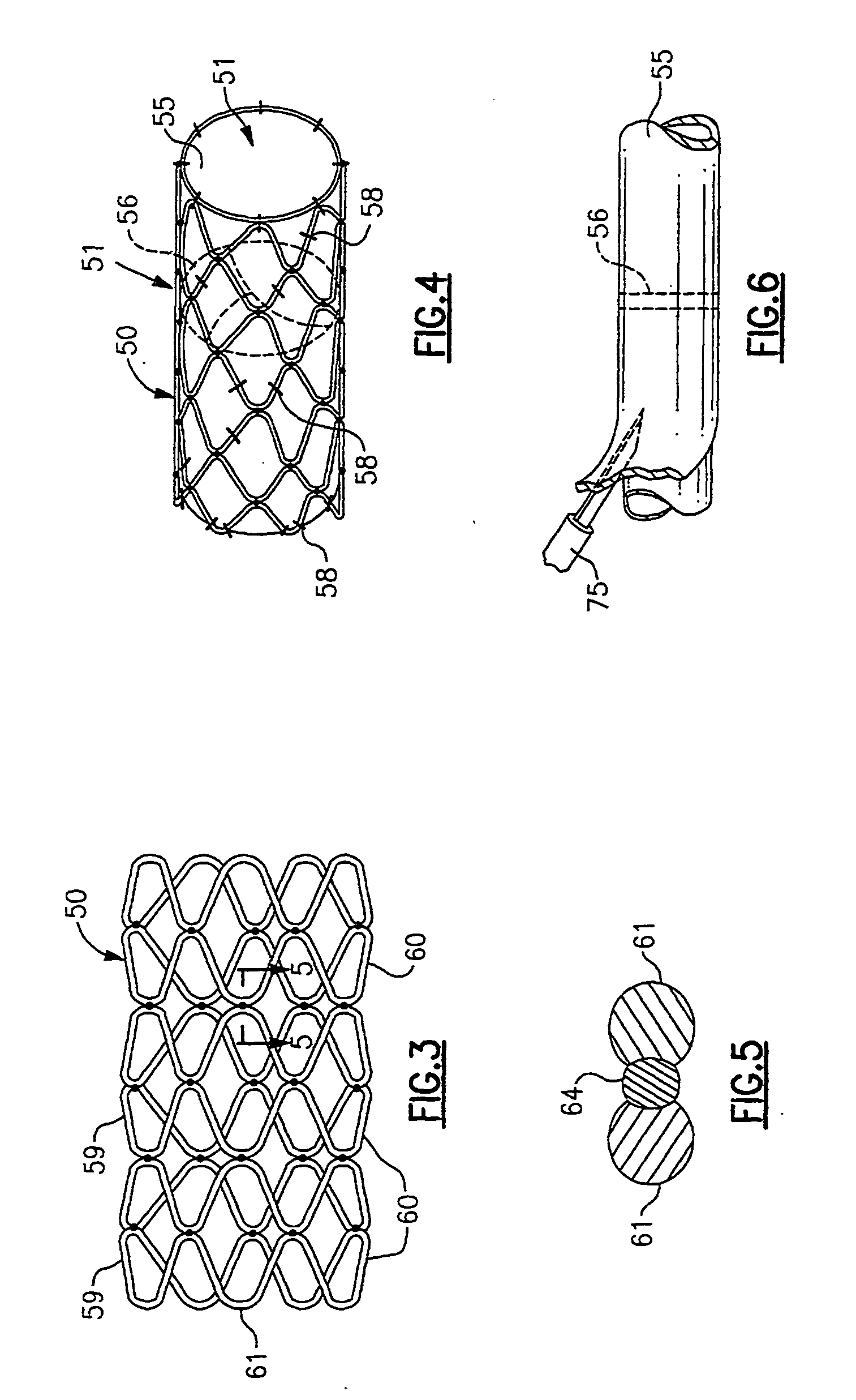 System for implanting a replacement valve