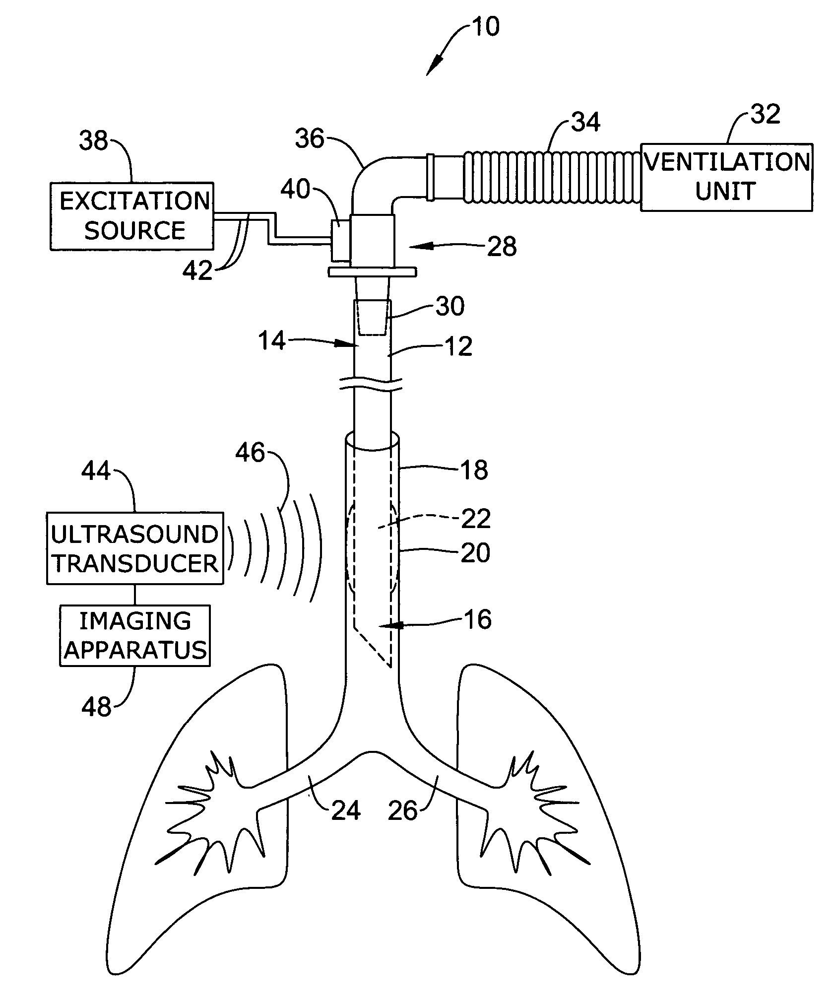 Ultrasonic placement and monitoring of an endotracheal tube