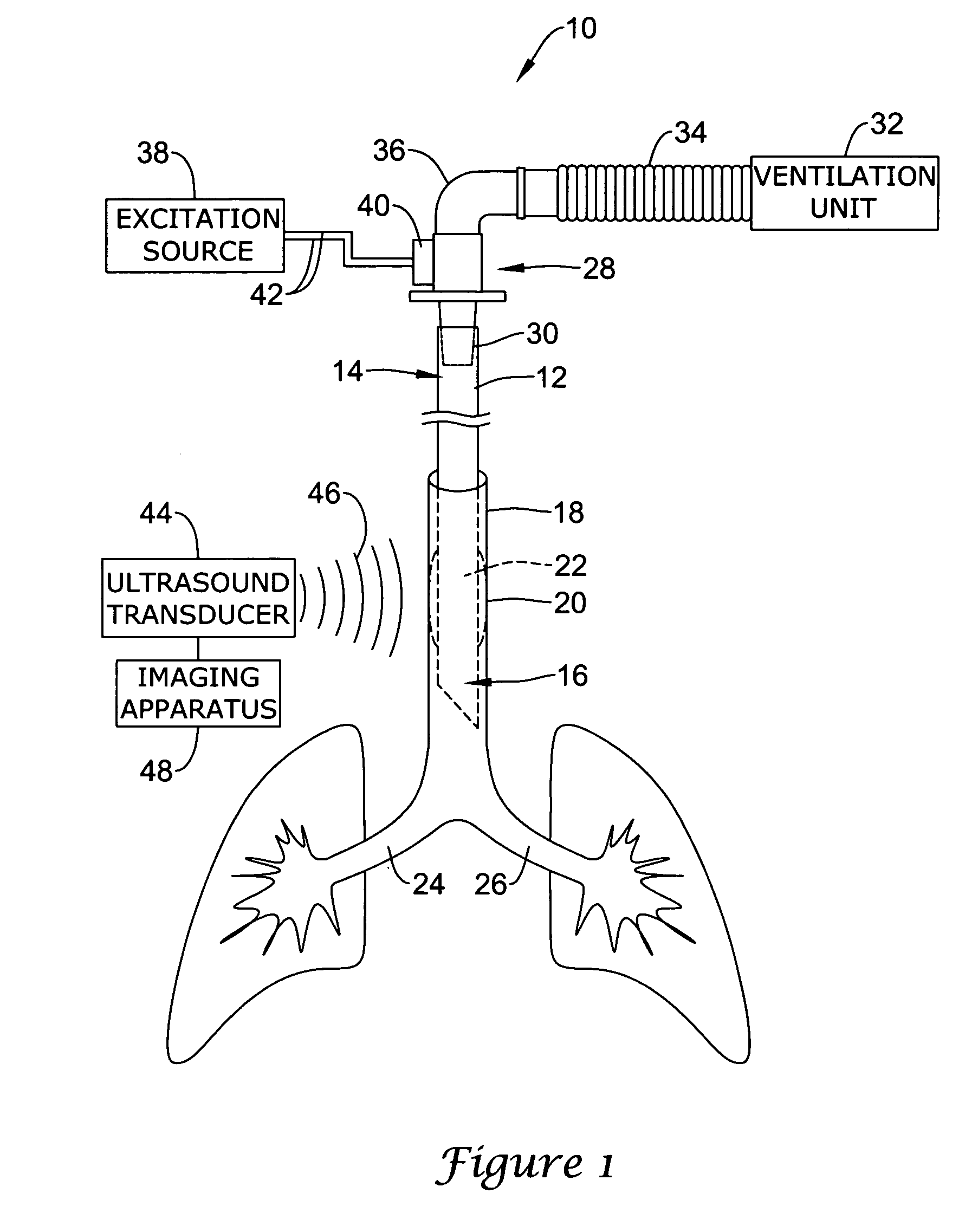 Ultrasonic placement and monitoring of an endotracheal tube