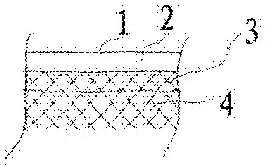 Implant comprising a non-woven fabric