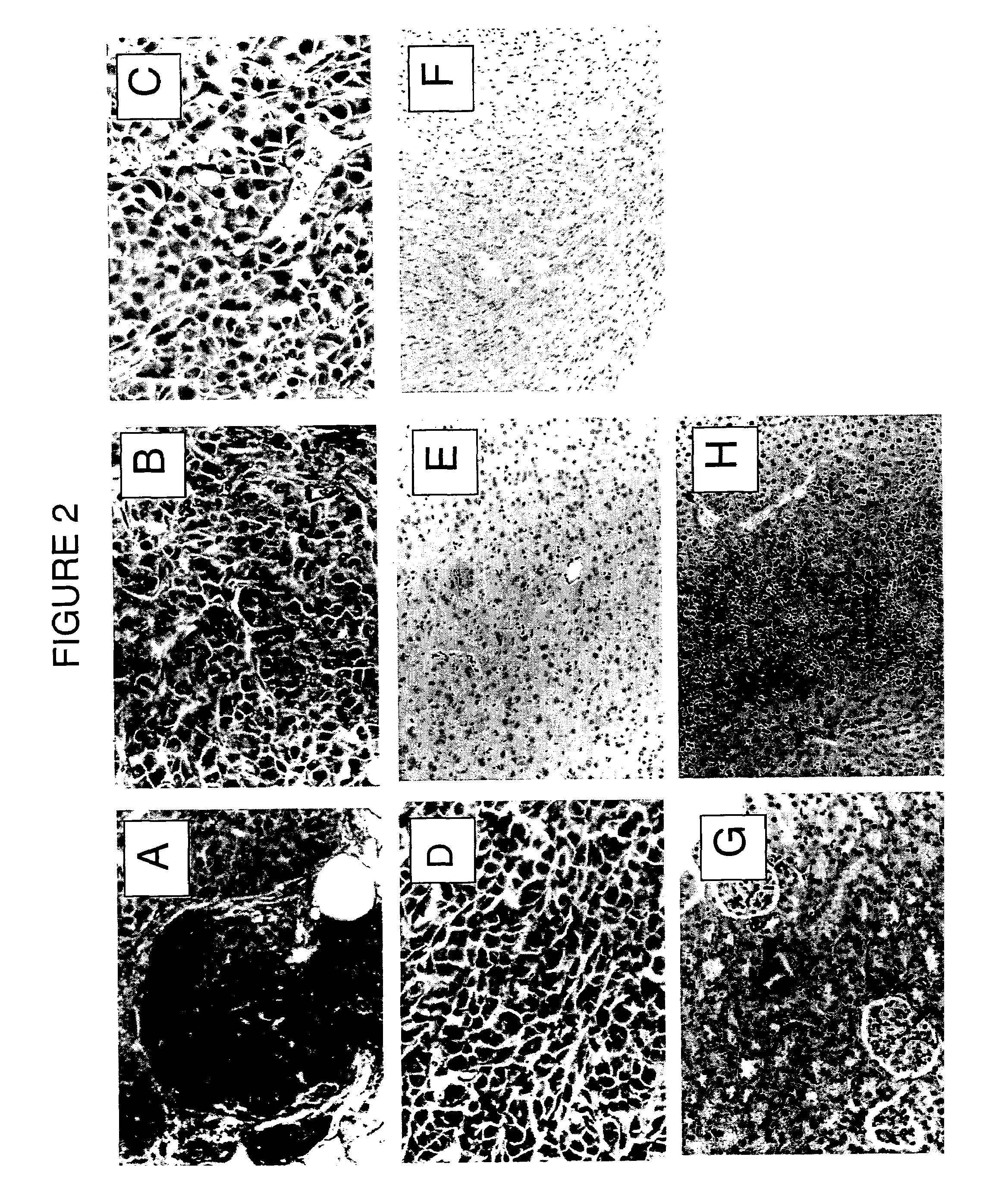 Collagen-binding molecules that selectively home to tumor vasculature and methods of using same