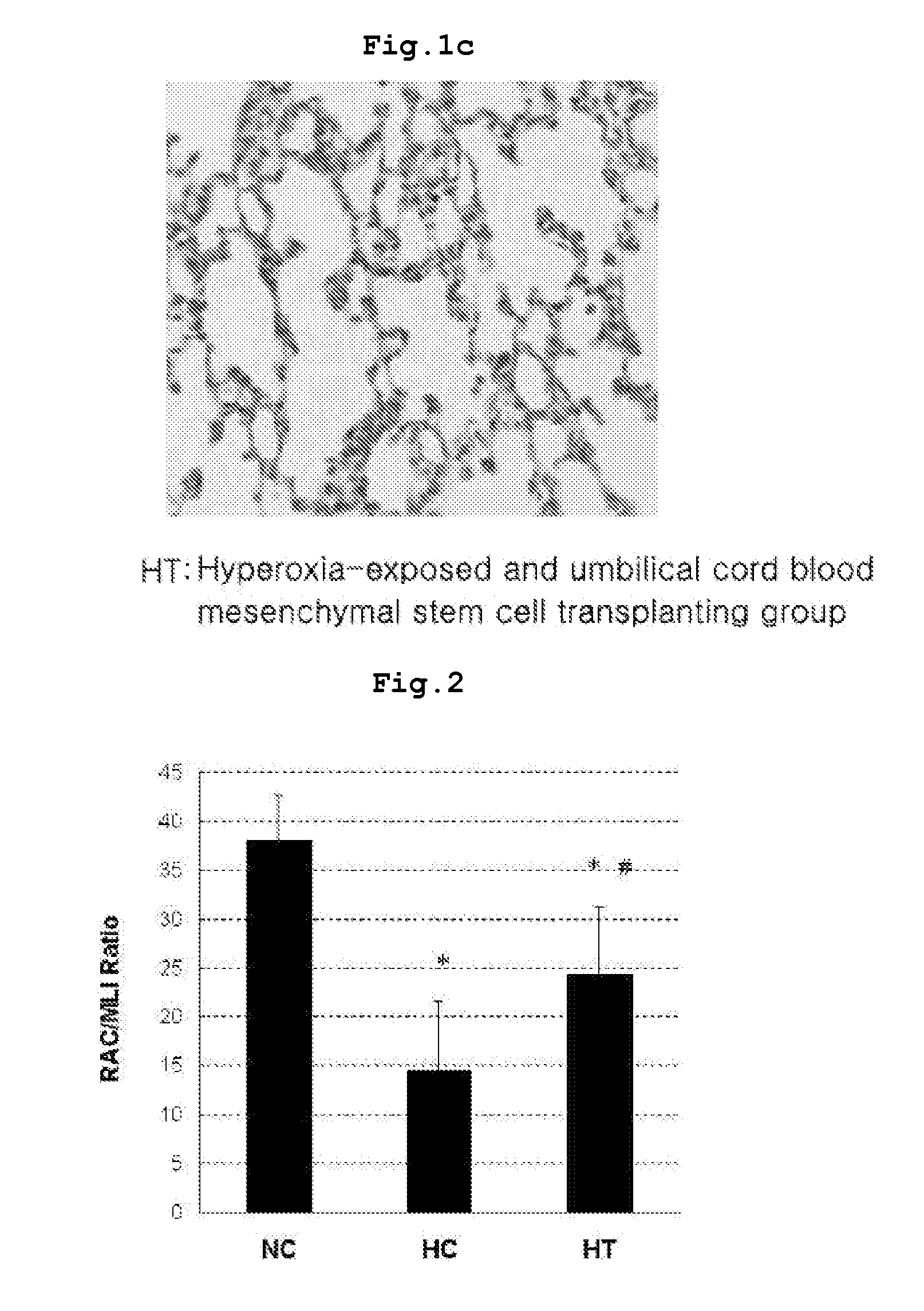 Composition Comprising Separated or Proliferated Cells from Umbilical Cord Blood for Treating Developmental and/or Chronic Lung Disease