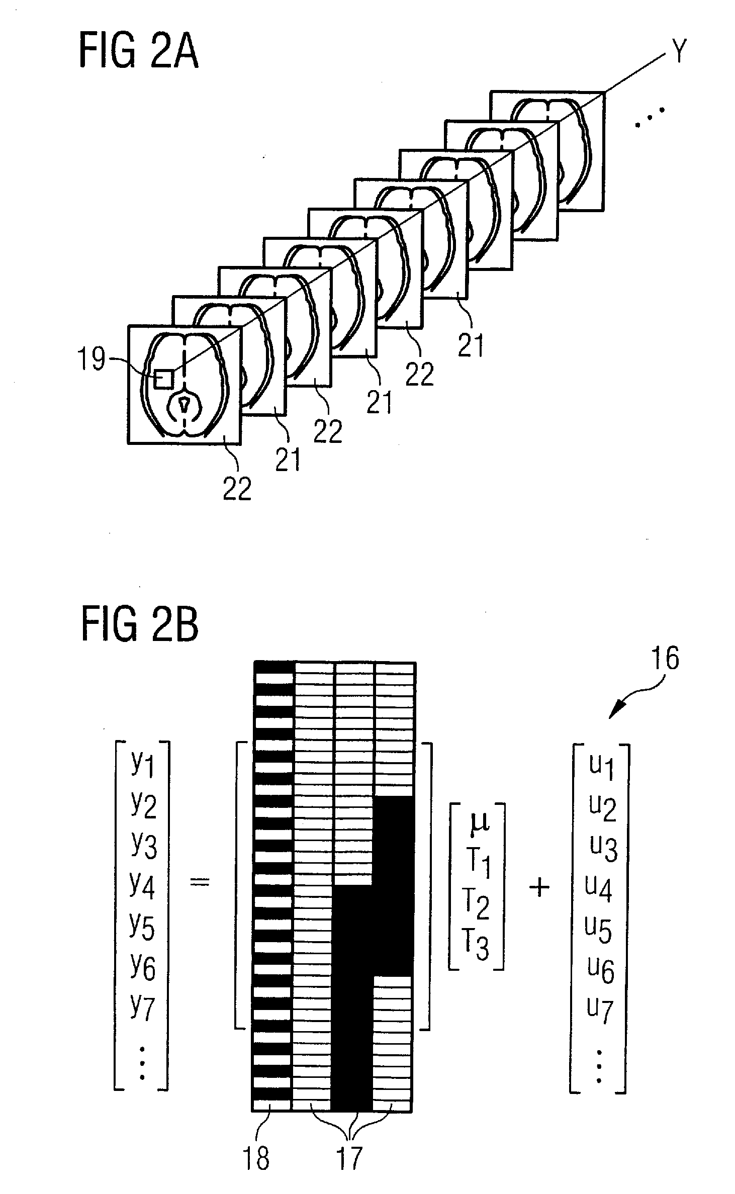Magnetic resonance device and method for perfusion determination