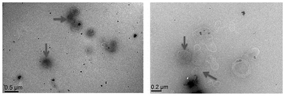 Nanocomposite with adenosine wrapped by exosome and application thereof
