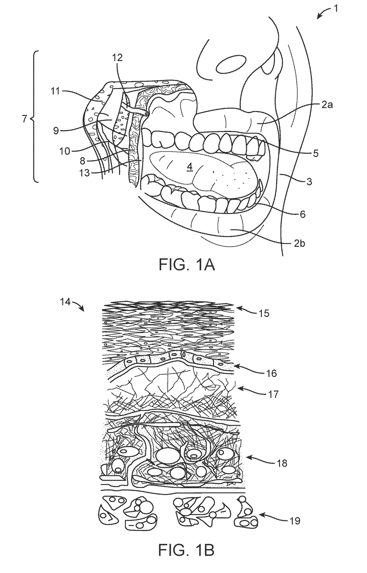 Apparatus and methods for rapid transmucosal drug delivery