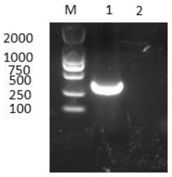 A recombinant Bacillus subtilis producing antimicrobial peptide cecropin B, its construction method and its application