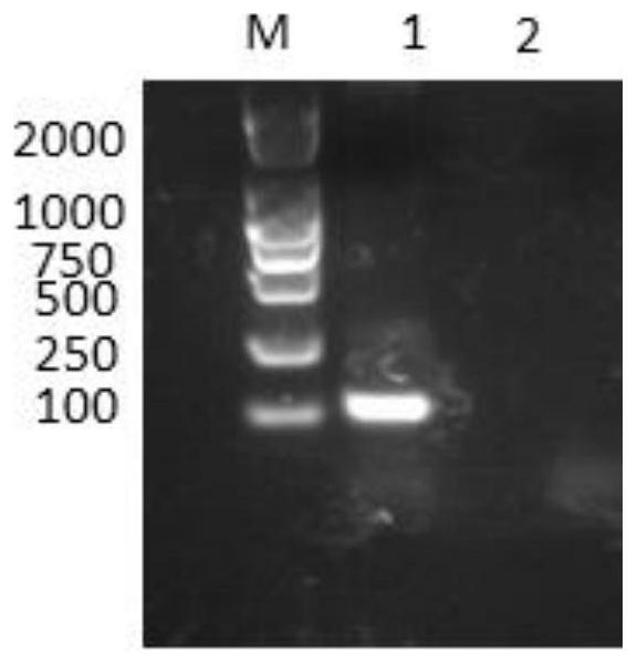 A recombinant Bacillus subtilis producing antimicrobial peptide cecropin B, its construction method and its application