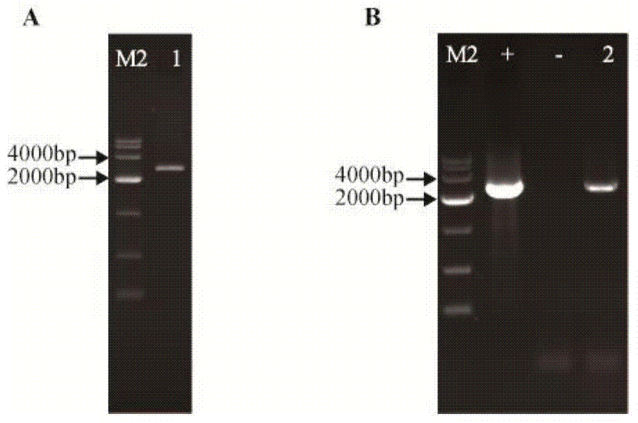 Transcription factor Asg1p for regulating and controlling acid stress resistance of Candida glabrata