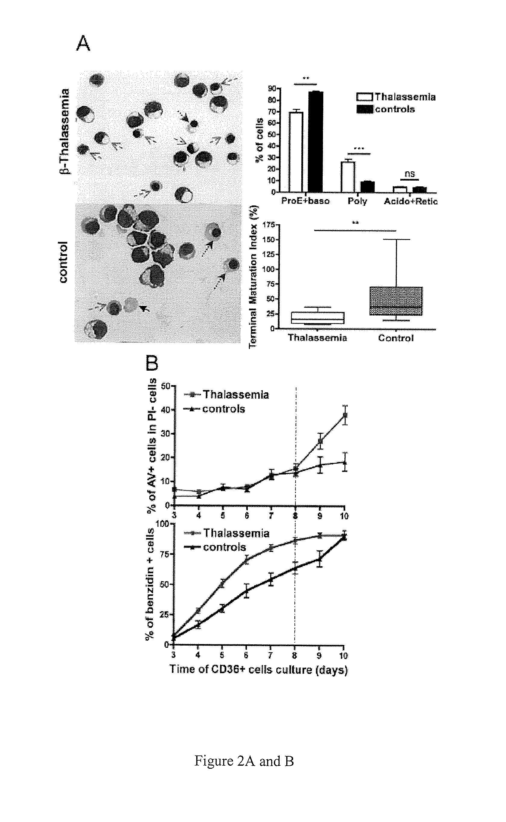 Methods and compositions for the treatment of beta-thalassemia