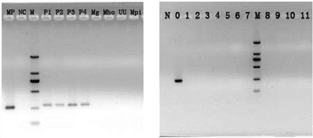 A kind of pcr primer for detecting mycoplasma pneumoniae and its application