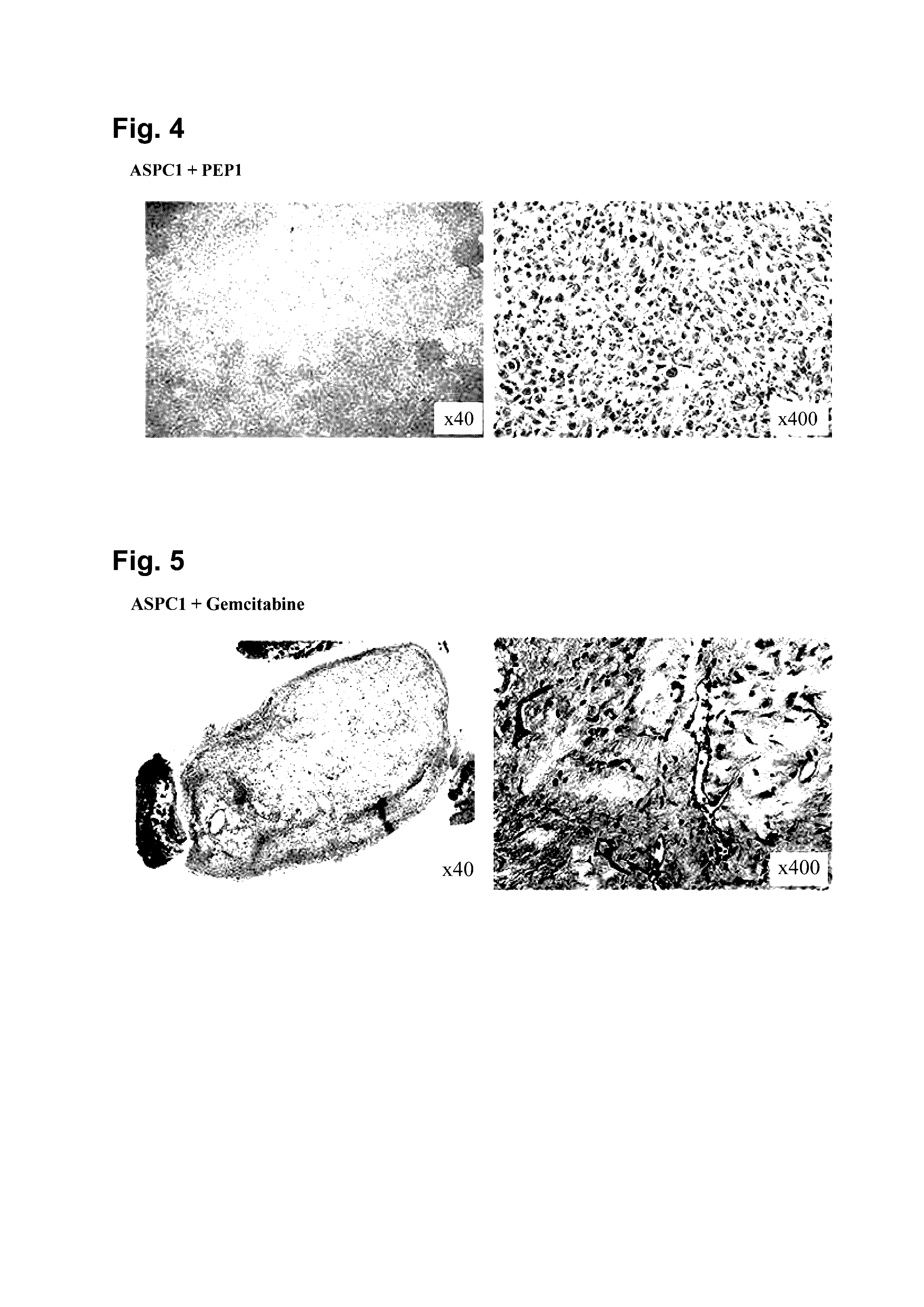 Peptide Having Fibrosis Inhibitory Activity and Composition Containing Same