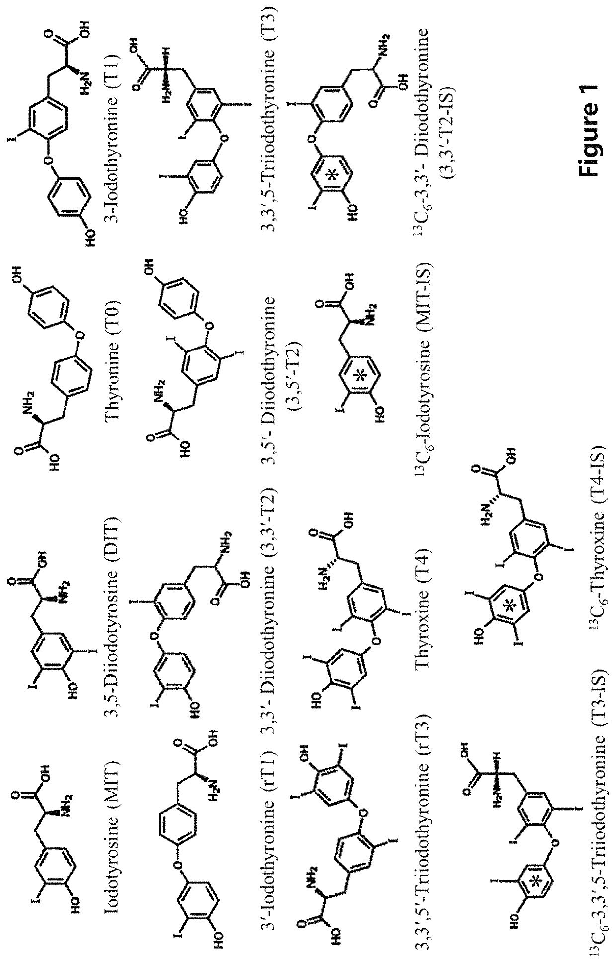 Method and a kit for simultaneous analyses of thyroid hormones and related metabolites in serum