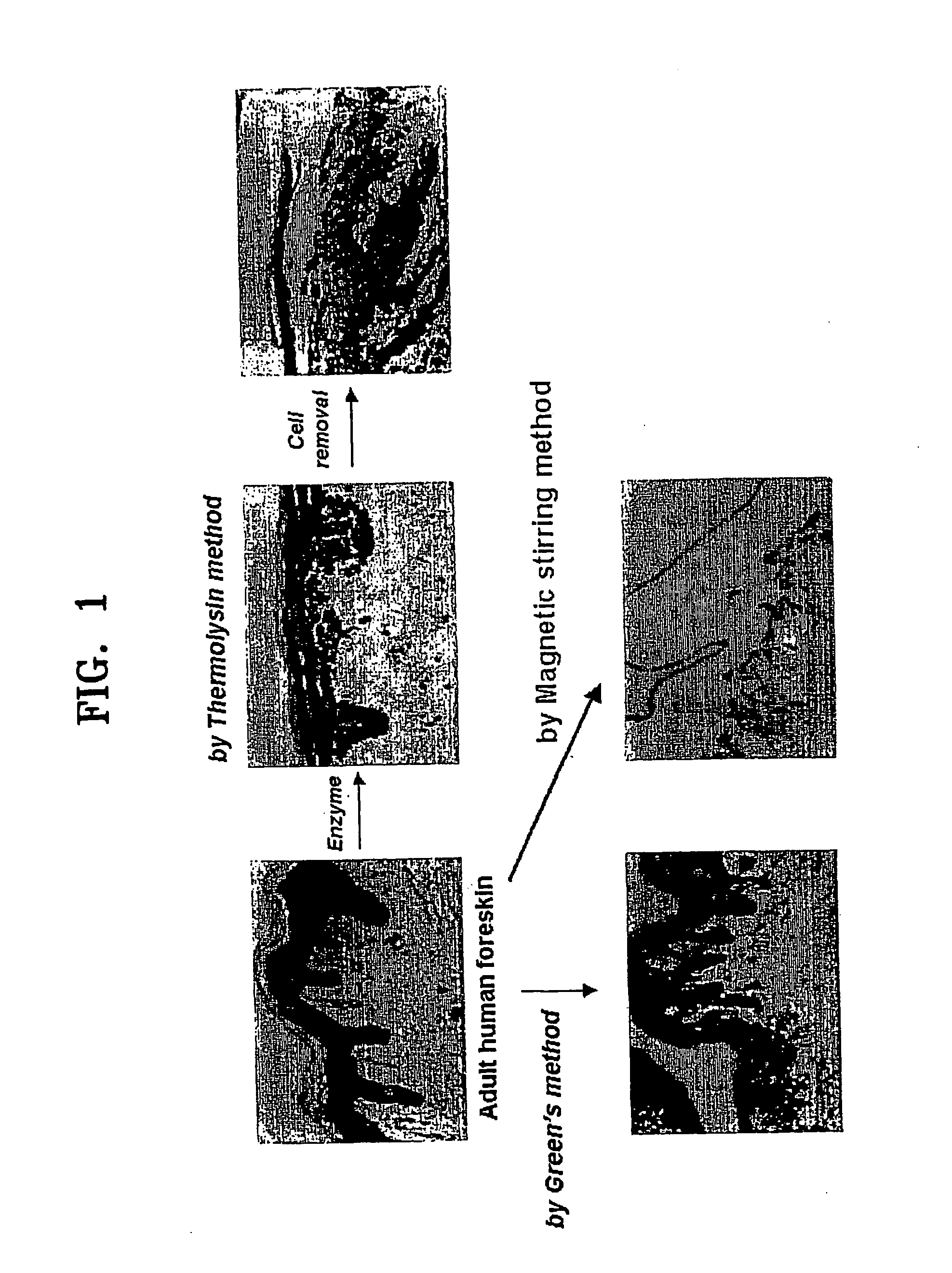 Method of isolating epithelial cells, method of preconditioning cells, and methods of preparing bioartificial skin and dermis with the epithelial cells or the preconditioned cells