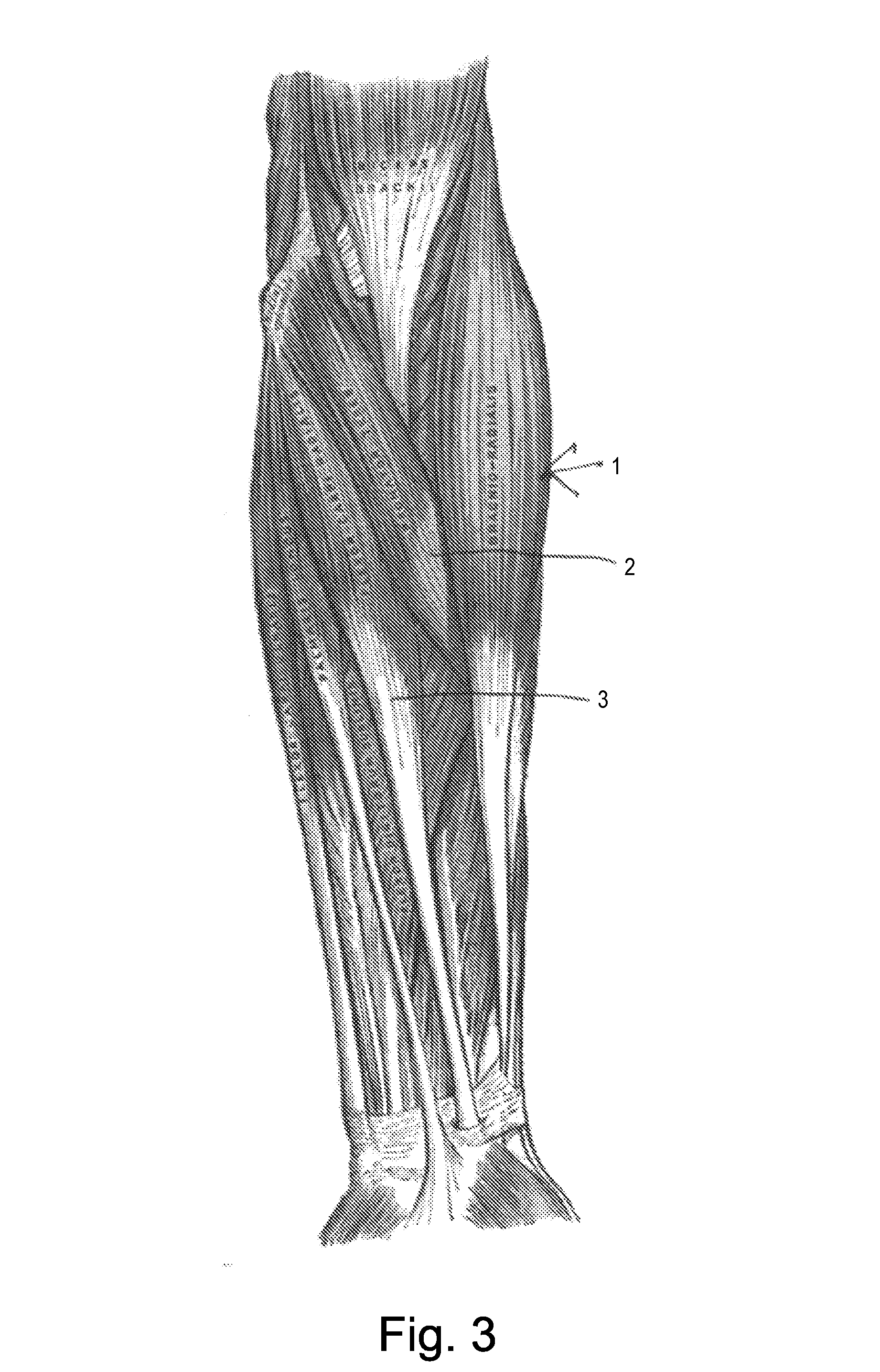 Method for instantly relieving tissue inflammation