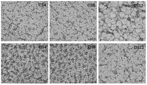 Compound feed for relieving liver glycogen accumulation of micropterus salmoides and preparation method of compound feed