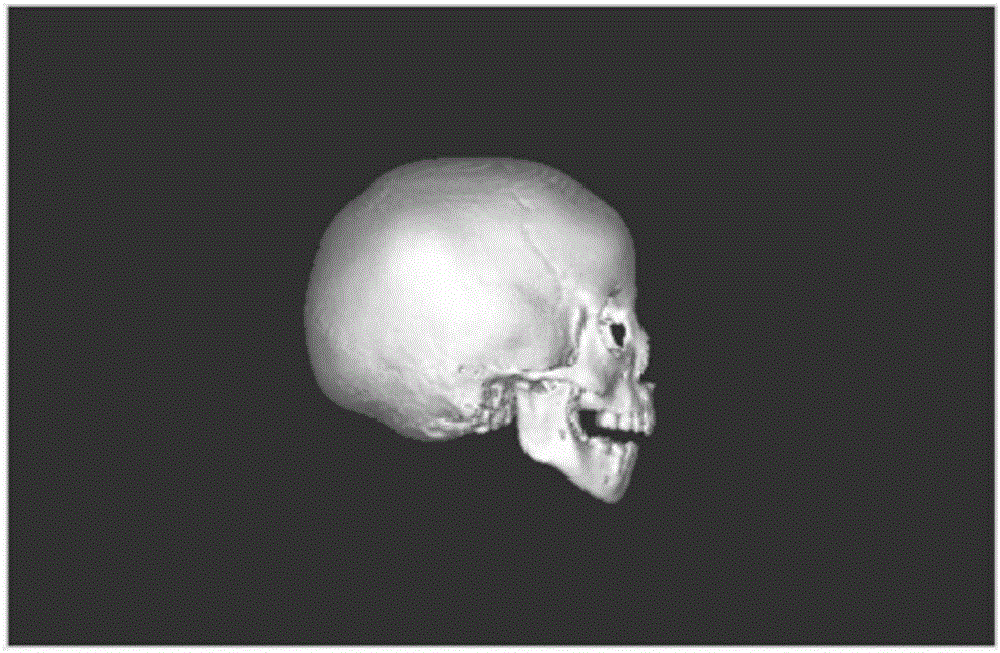Head thin-layer CT scanning data based frontal bone angle measurement method
