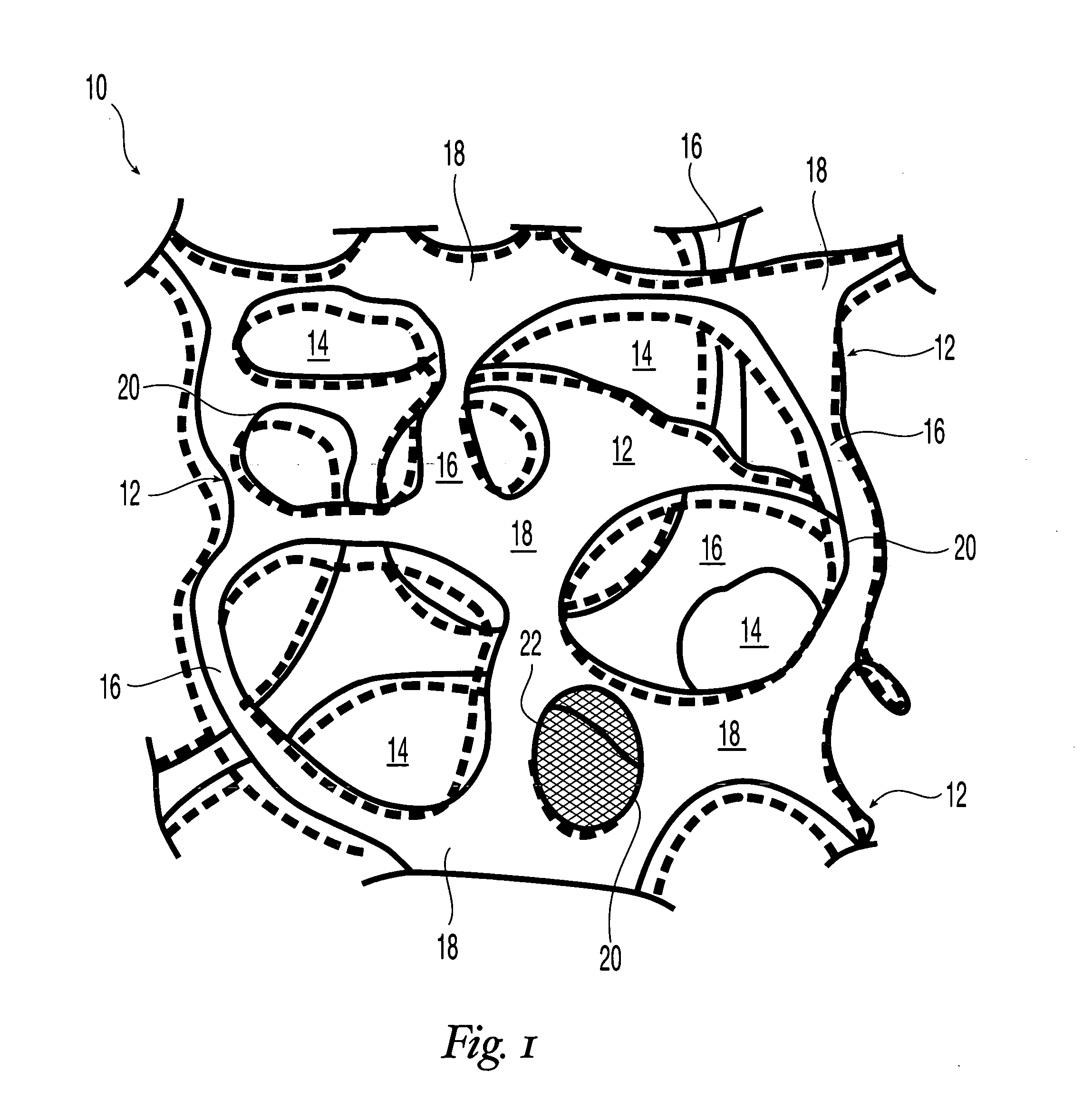 Reticulated elastomeric matrices, their manufacture and use in implantable devices