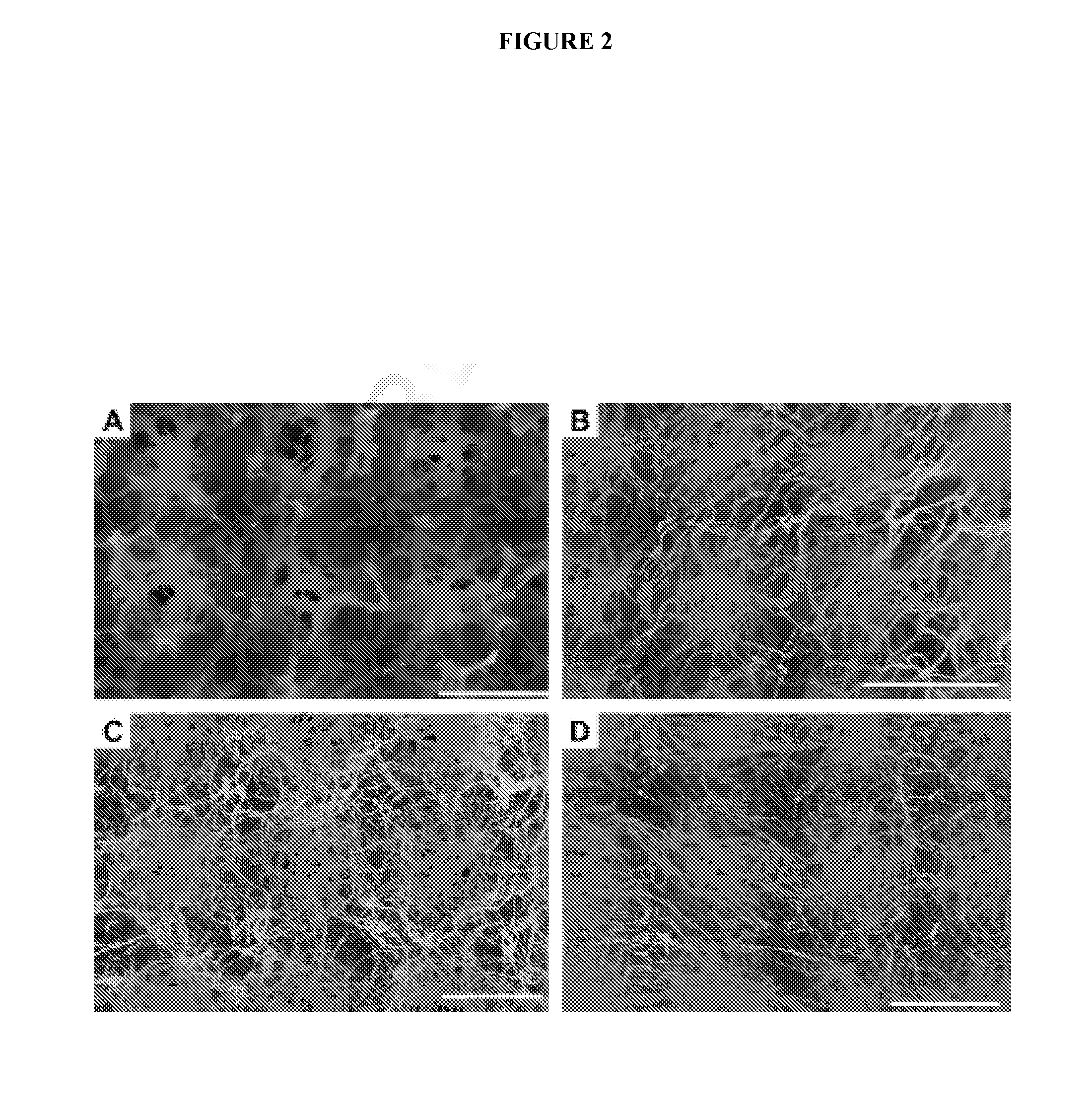 Interpenetrating biomaterial matrices and uses thereof