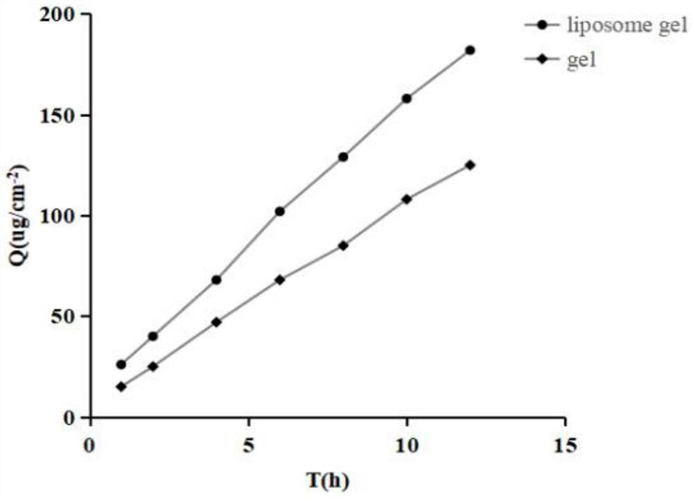 Timolol maleate liposome gel and preparation method thereof