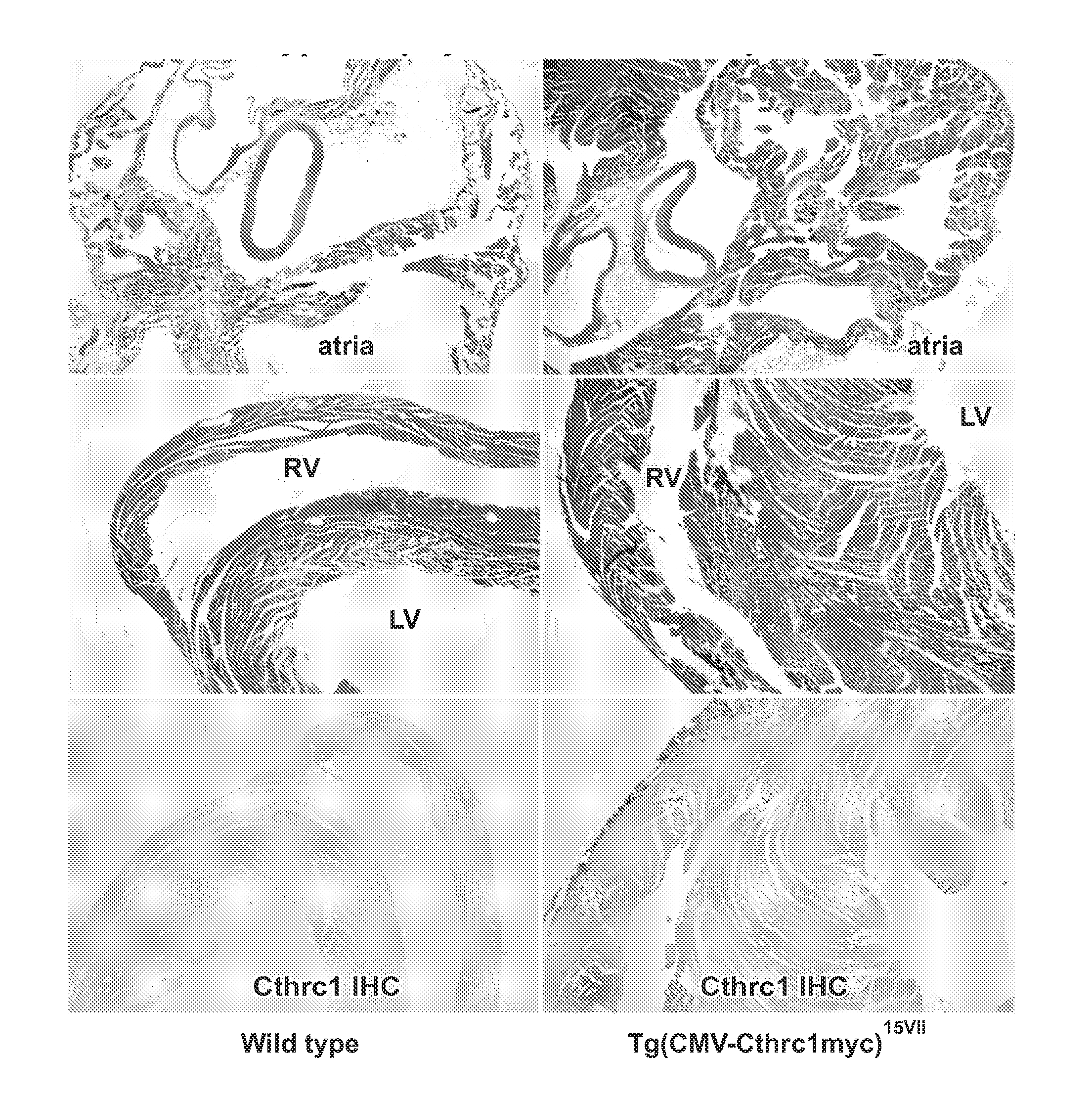 Compositions and methods for the treatment of cardiac and vascular disease