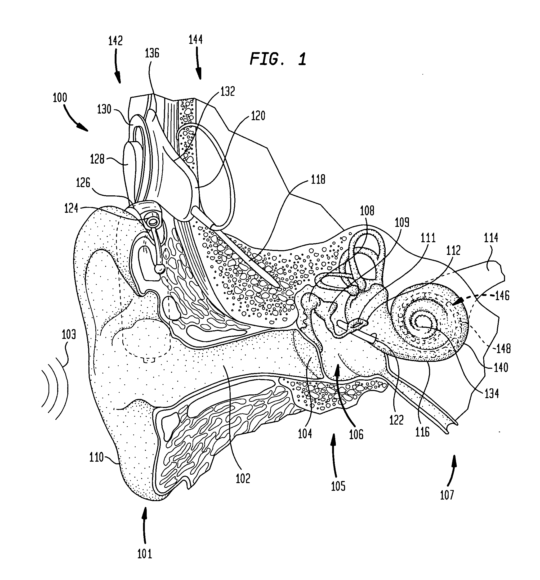 Electrode assembly for a stimulating medical device