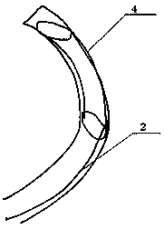 A novel split-type intracranial stent graft system and its application method