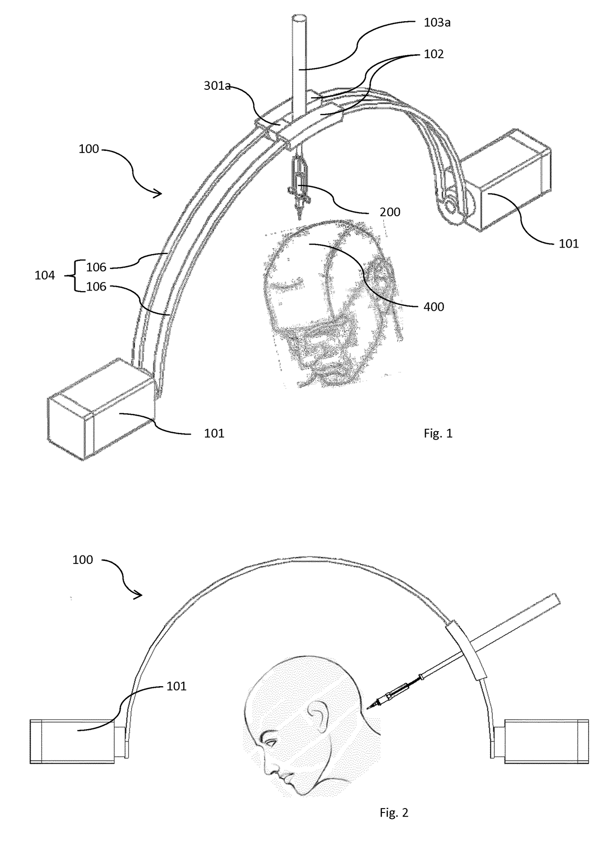 A device and method for follicular unit transplantation