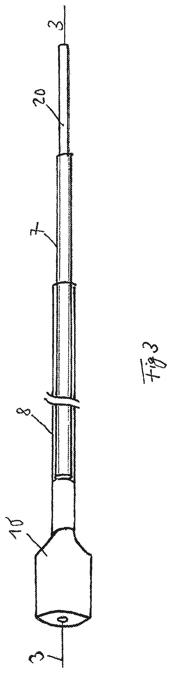 Vacuum sponge drainage