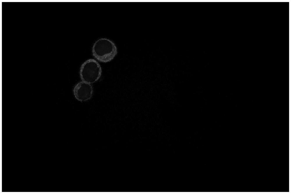 A kind of HER2 antibody immunomagnetic beads and preparation method thereof