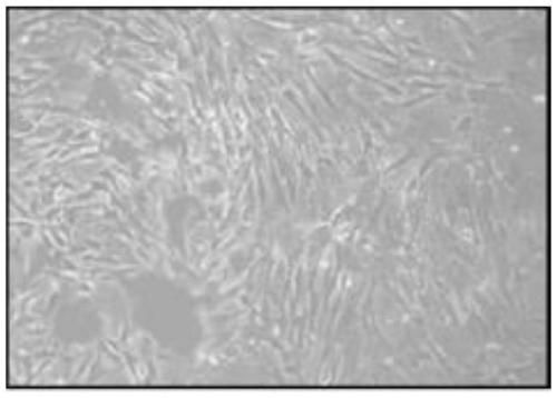 Stem cell factor microvesicle preparation coming from human umbilical cord mesenchymal stem cells and preparation method thereof