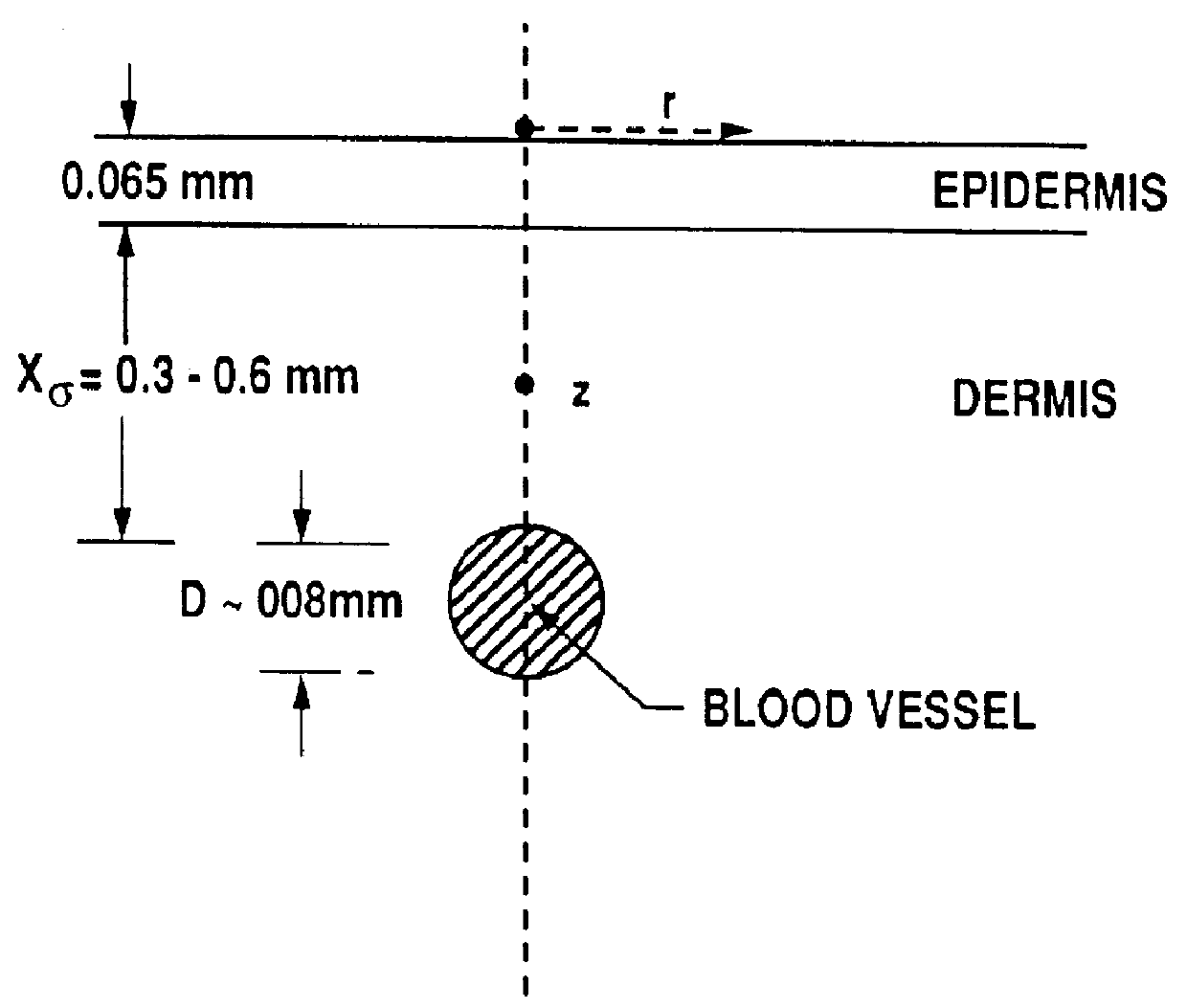 Optical system for treatment of vascular lesions