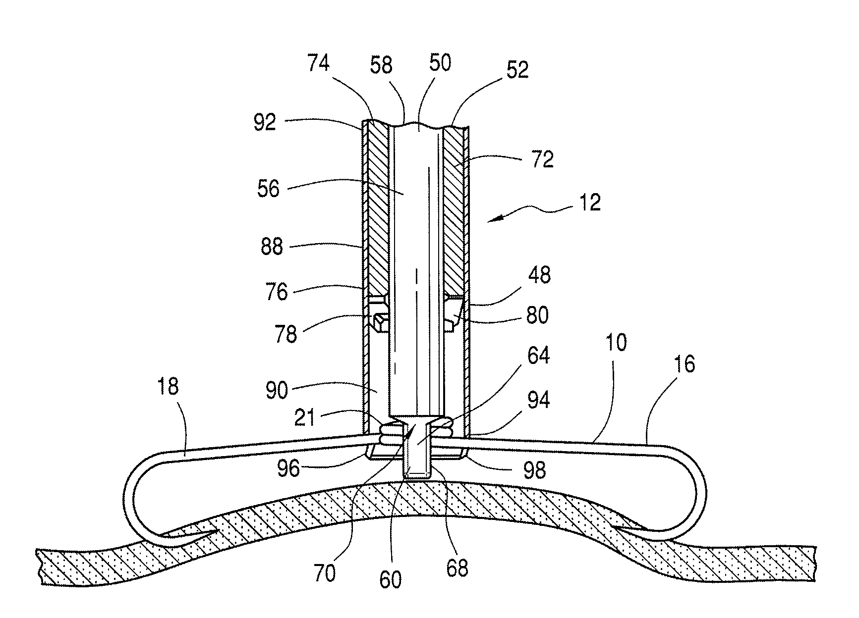 Clip and delivery assembly used in forming a tissue fold