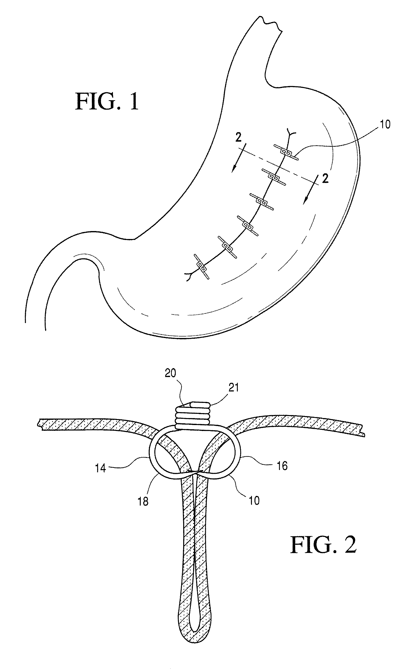 Clip and delivery assembly used in forming a tissue fold