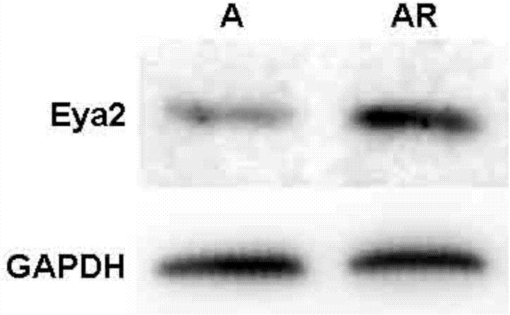 siRNA capable of specifically inhibiting expression of Eya2 gene as well as recombinant vector and application of siRNA