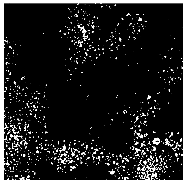 Method of detecting extracellular vesicle surface PD-L1 protein by aptamer of programmed death receptor-ligand 1 (PD-L1)