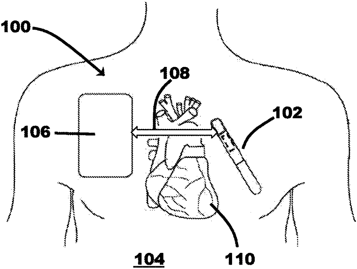Enhanced wearable therapy device paired with insertable cardiac monitor