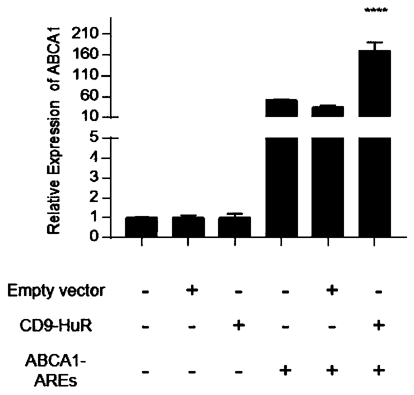 Exosome loading ABCA1 mRNA and construction method and application thereof