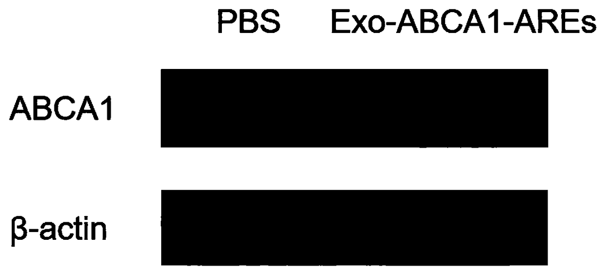 Exosome loading ABCA1 mRNA and construction method and application thereof