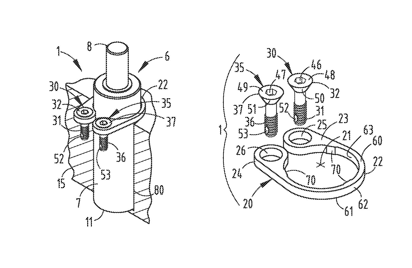 Gas spring mounting assembly and method for metal forming dies