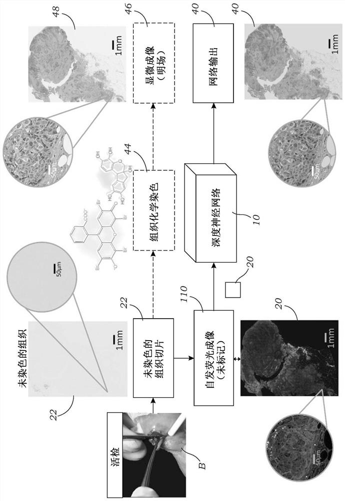 Method and system for digital staining of label-free fluorescence images using deep learning