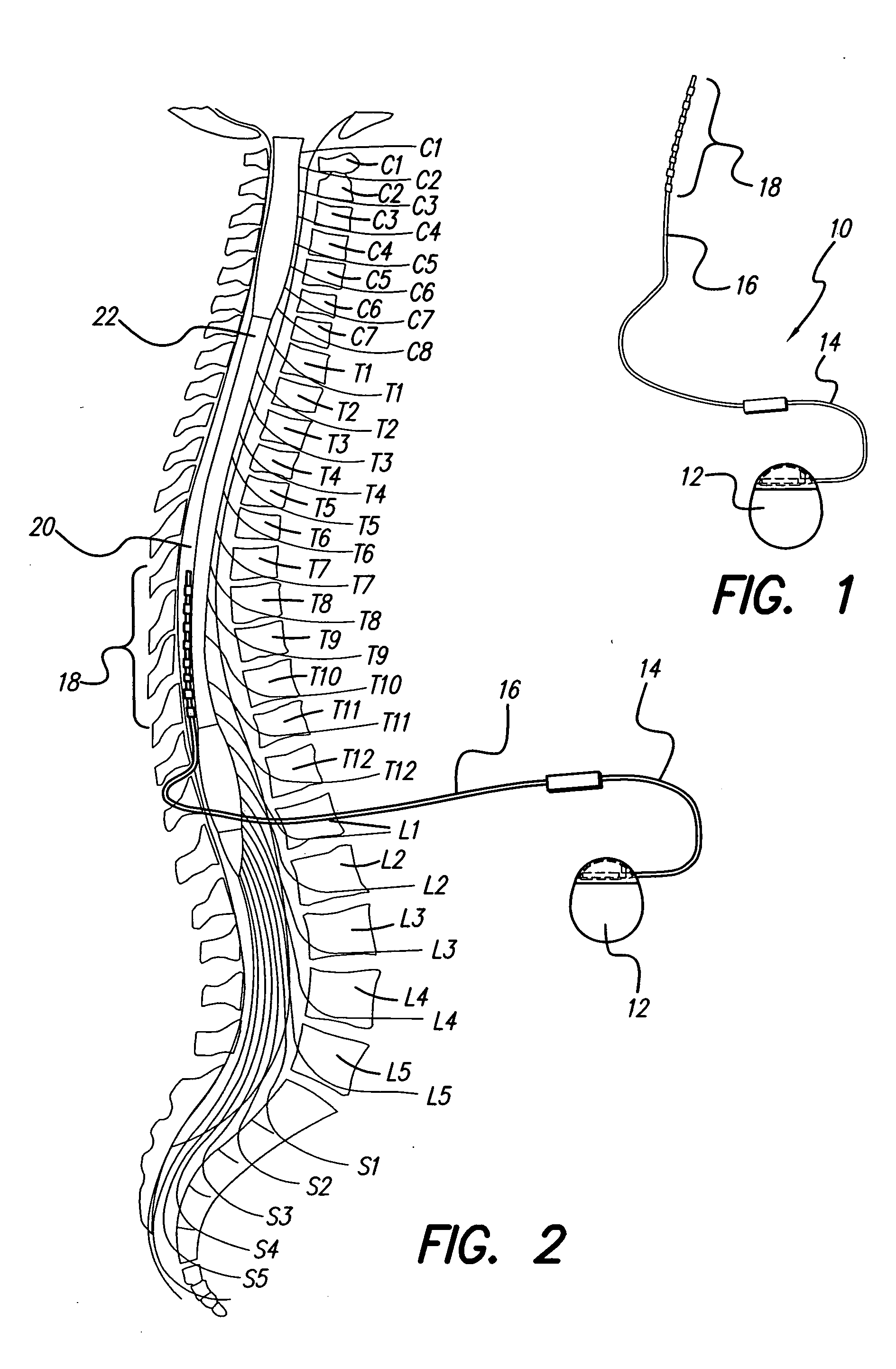 Method for programming implantable device