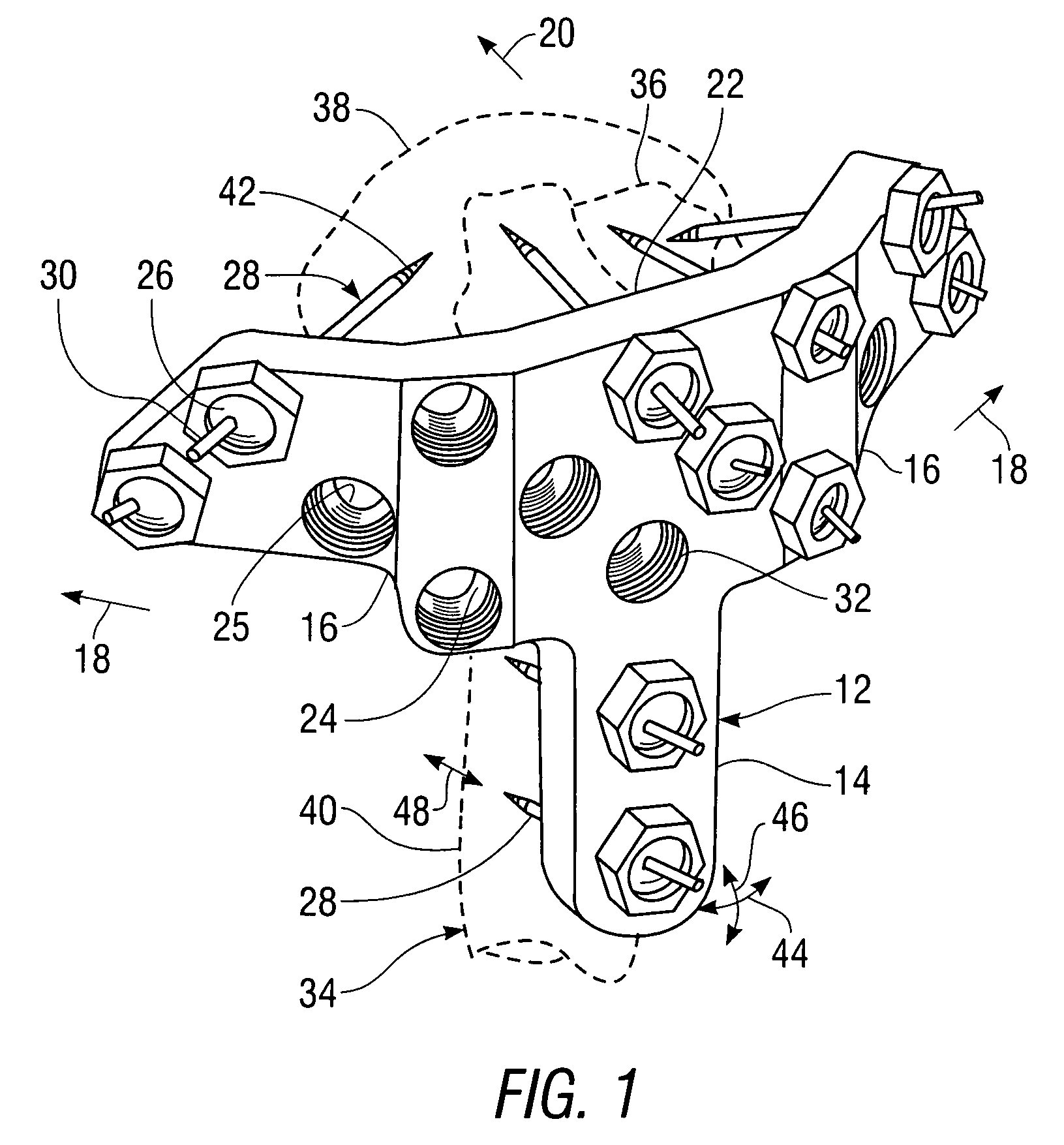 Apparatus for external fixation of a fractured distal radius with angularly adjustable pin clamping means