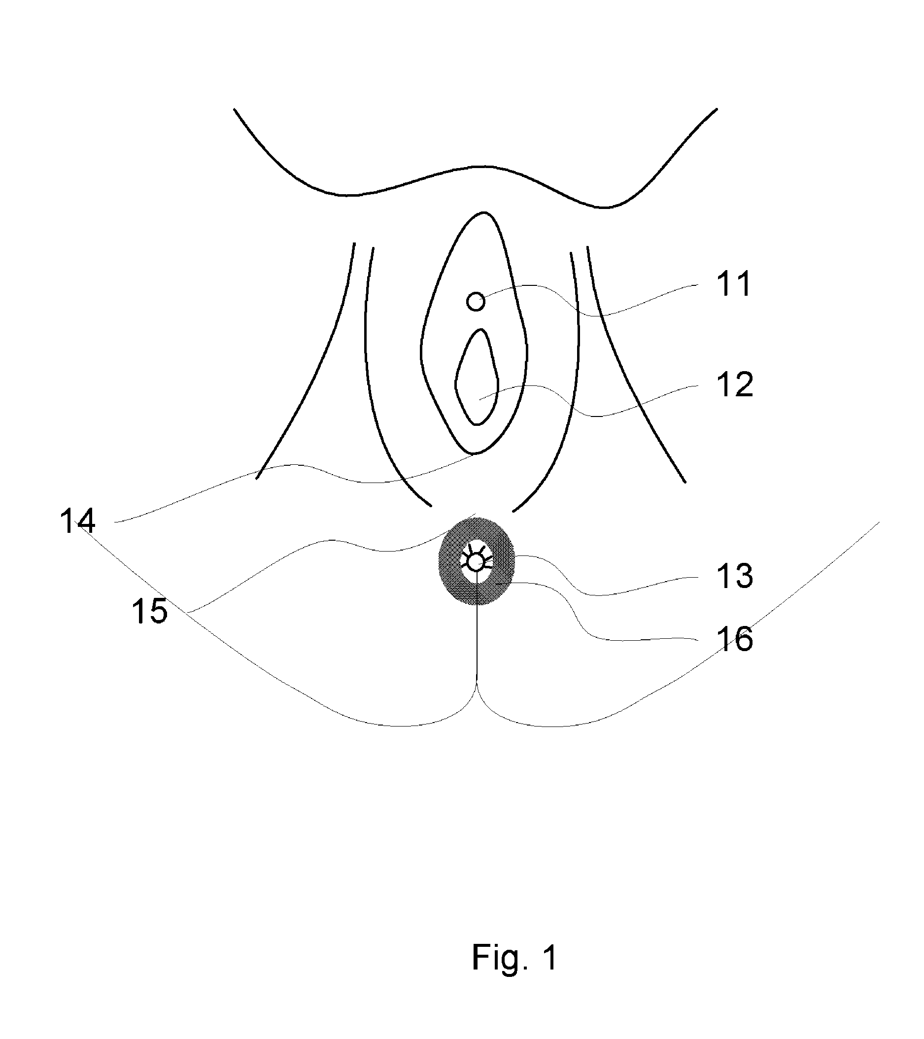 Device for tissue damage protection during child delivery