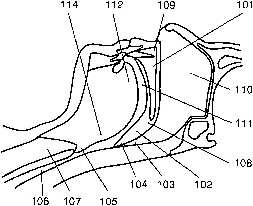 Adjustable soft palate supporting body