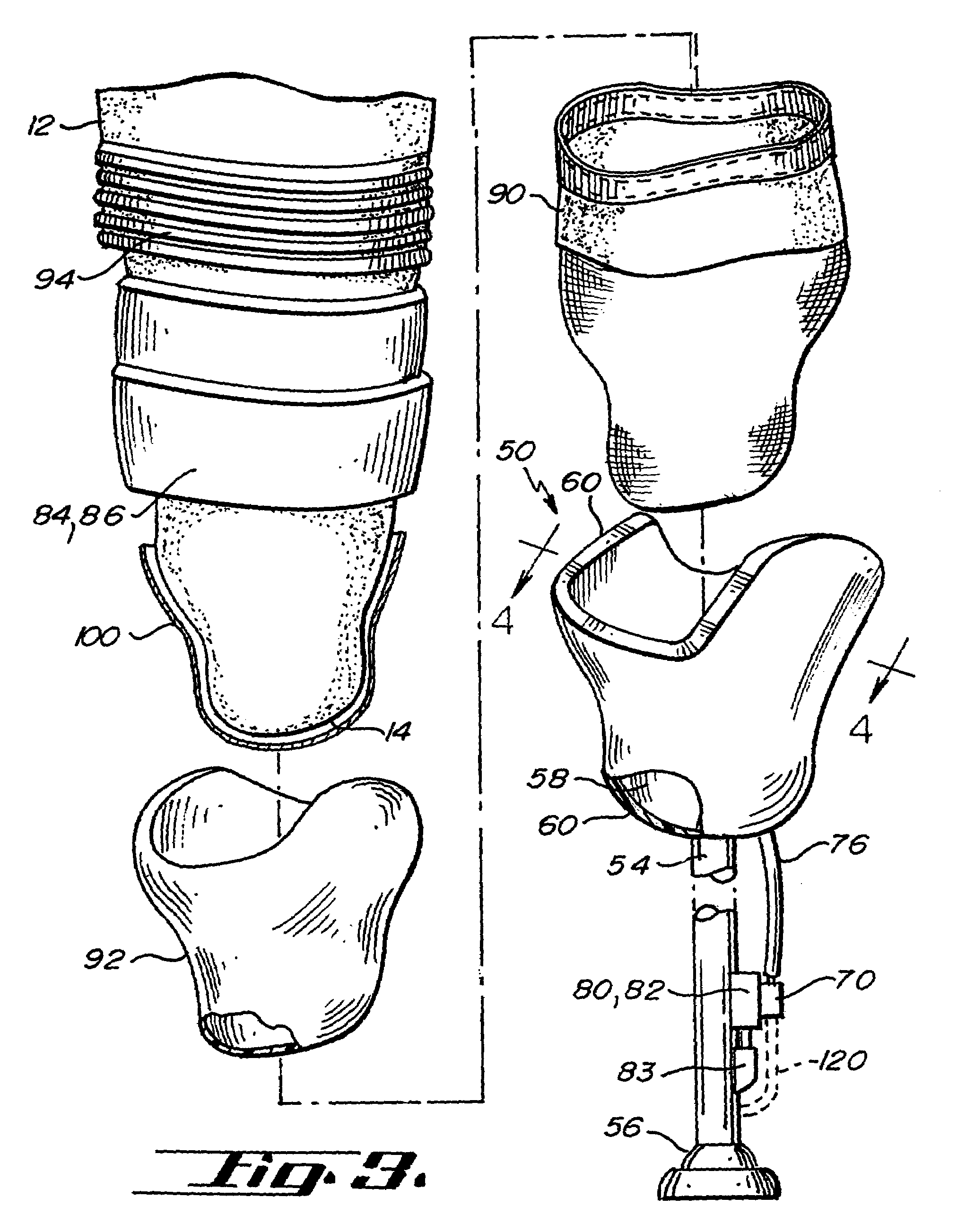 Osmotic membrane and vacuum system for artificial limb