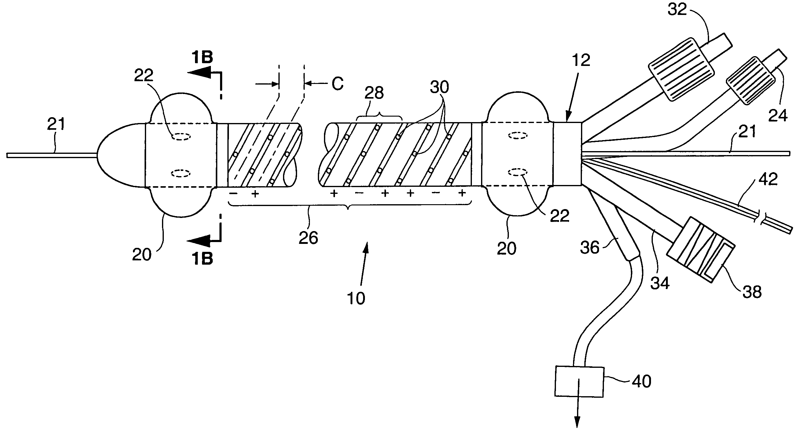 Apparatus and method for treating venous reflux