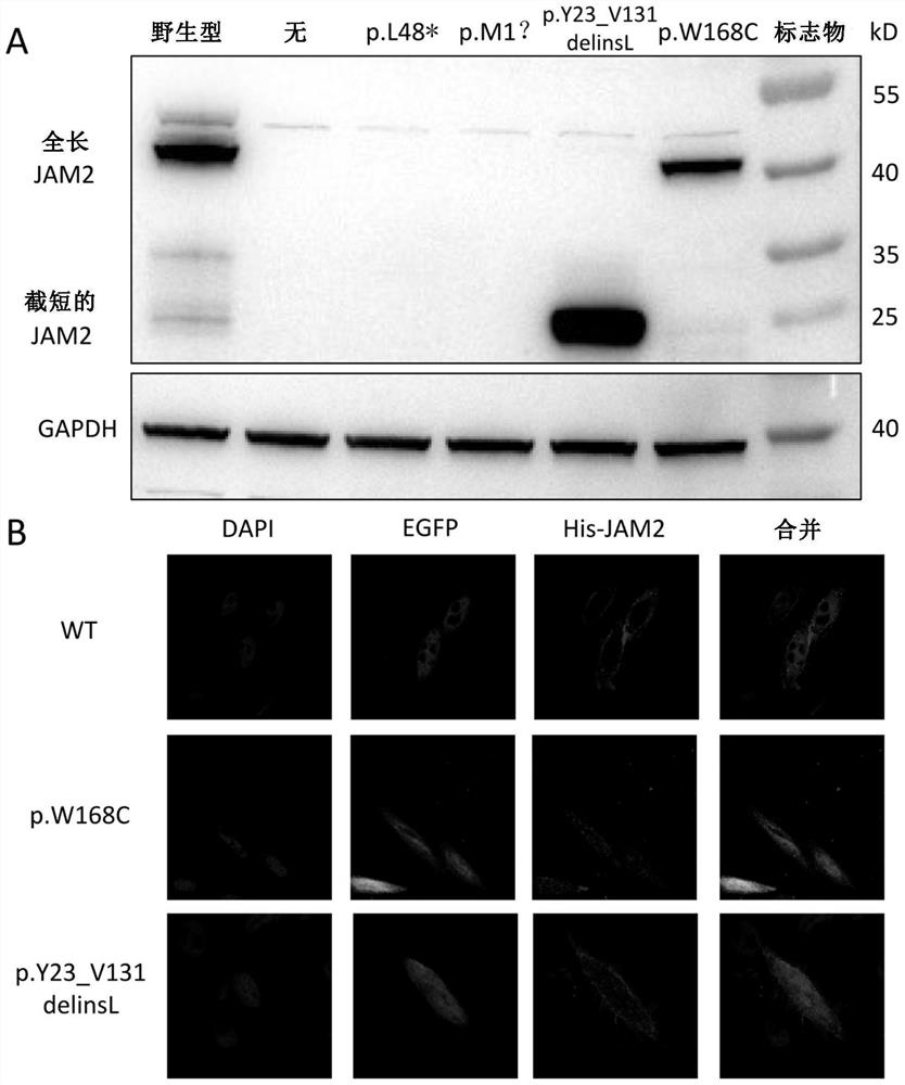 Primary familial cerebral calcification pathogenic gene jam2 and its application