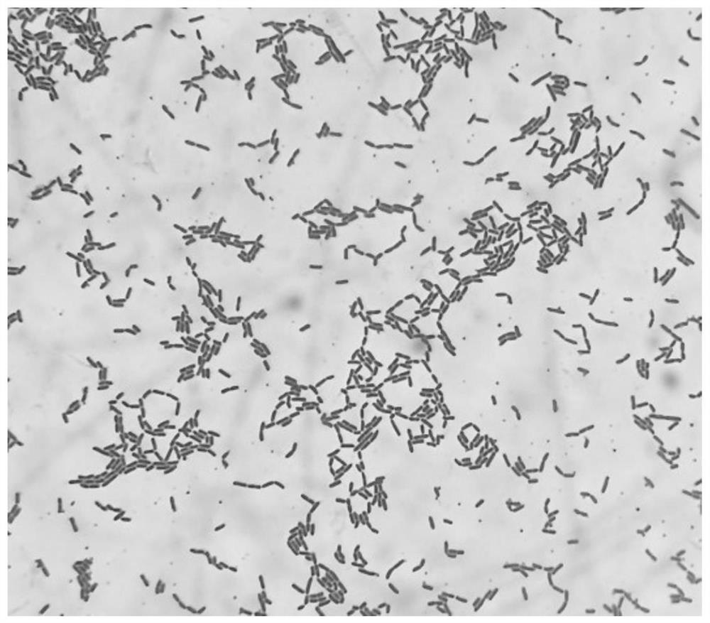 Lactobacillus plantarum capable of producing urate oxidase and inhibiting xanthine oxidase and application of lactobacillus plantarum
