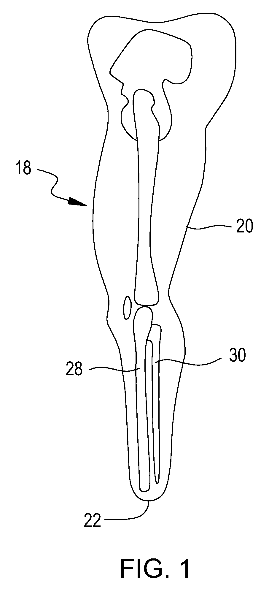 Vacuum assisted prosthetic sleeve and socket utilizing a double membrane liner