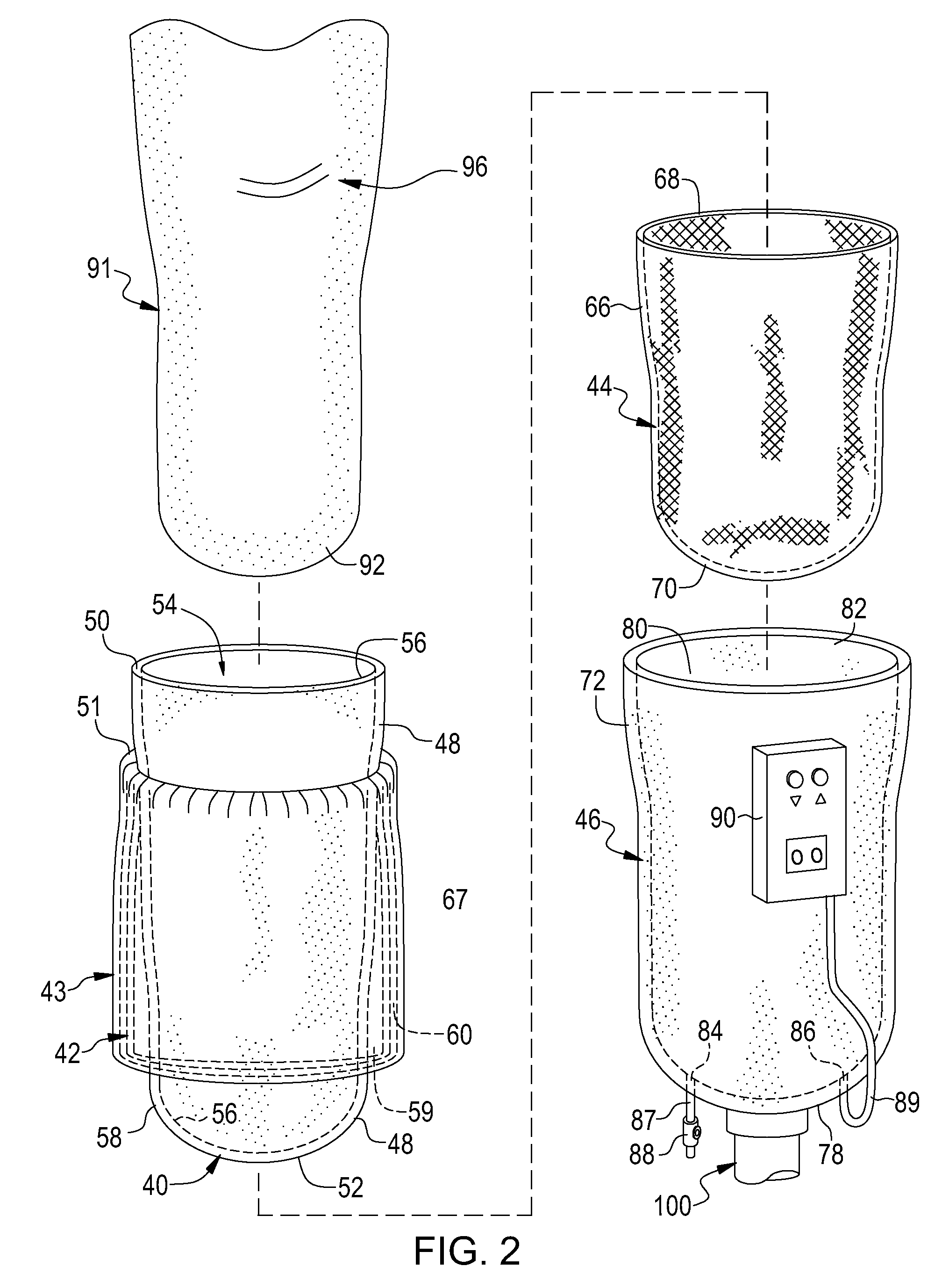 Vacuum assisted prosthetic sleeve and socket utilizing a double membrane liner